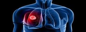Lung
